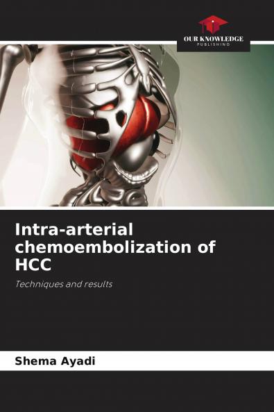 Intra-arterial chemoembolization of HCC