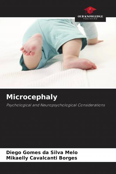 Microcephaly