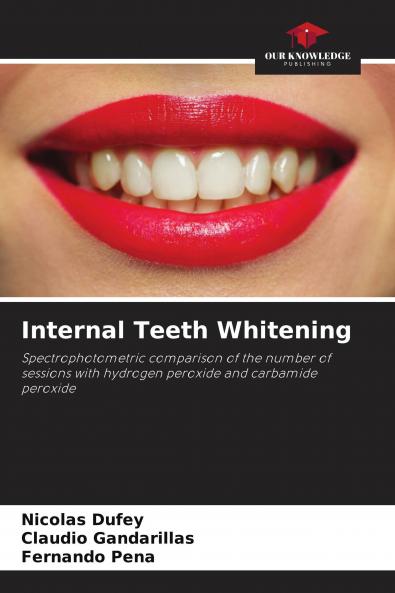 Internal Teeth Whitening