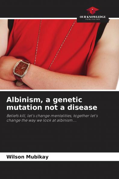 Albinism a genetic mutation not a disease