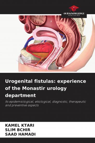 Urogenital fistulas