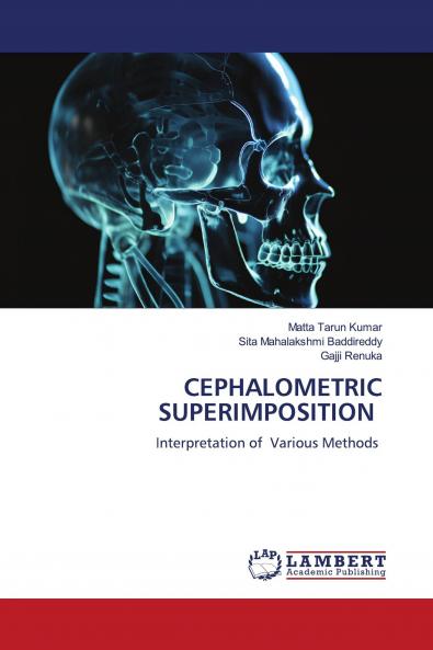 CEPHALOMETRIC SUPERIMPOSITION