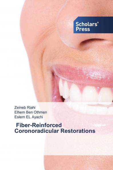 ��� Fiber-Reinforced Coronoradicular Restorations