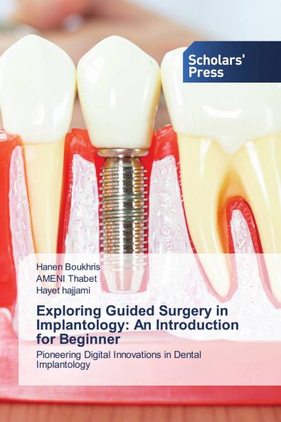 Exploring Guided Surgery in Implantology