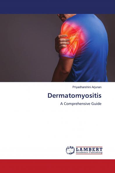 Dermatomyositis