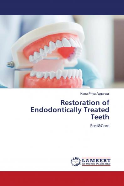 Restoration of Endodontically Treated Teeth