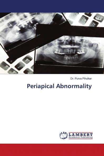 Periapical Abnormality
