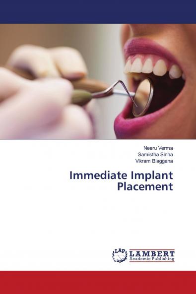 Immediate Implant Placement