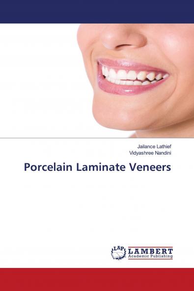 Porcelain Laminate Veneers