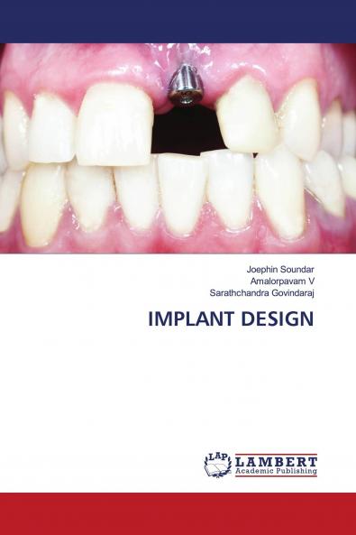IMPLANT DESIGN