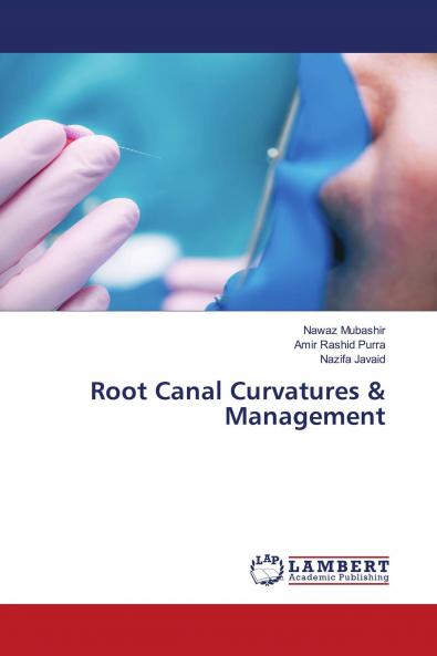 Root Canal Curvatures & Management