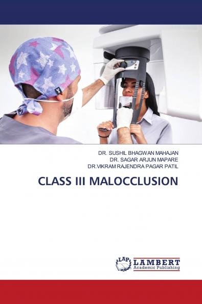 CLASS III MALOCCLUSION