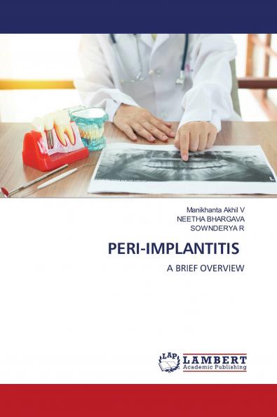 PERI-IMPLANTITIS