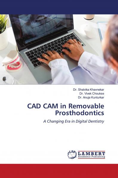 CAD CAM in Removable Prosthodontics
