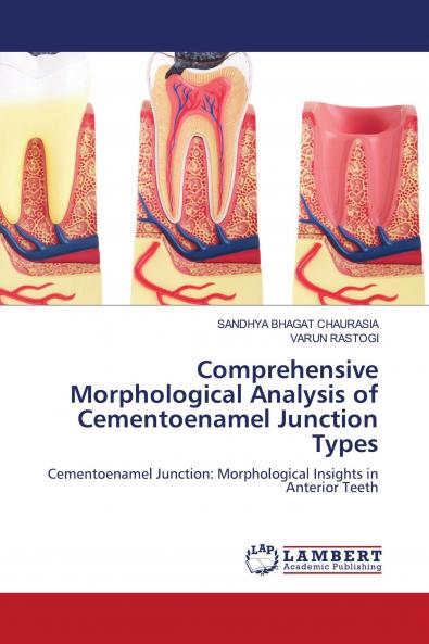 Comprehensive Morphological Analysis of Cementoenamel Junction Types