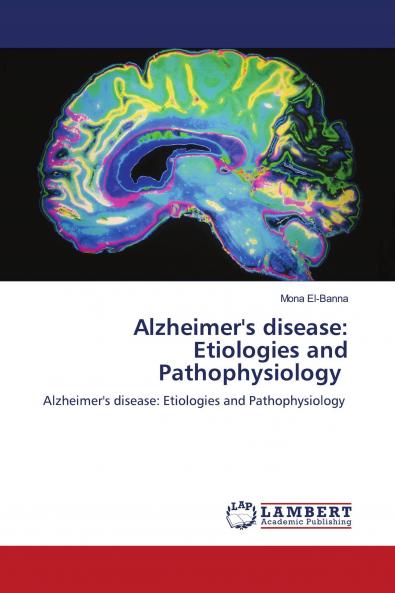 Alzheimer's disease