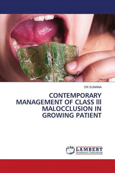 CONTEMPORARY MANAGEMENT OF CLASS lll MALOCCLUSION IN GROWING PATIENT