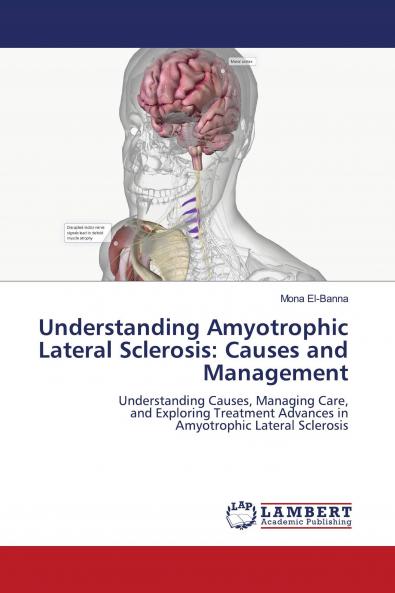 Understanding Amyotrophic Lateral Sclerosis: Causes and Management