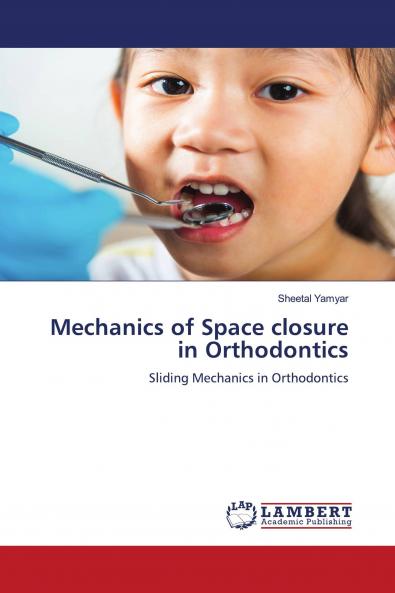 Mechanics of Space closure in Orthodontics