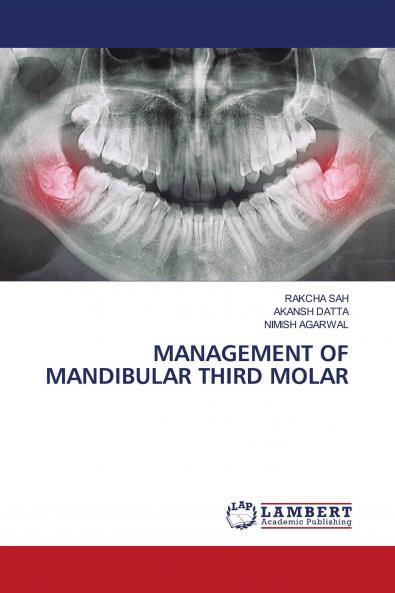 MANAGEMENT OF MANDIBULAR THIRD MOLAR