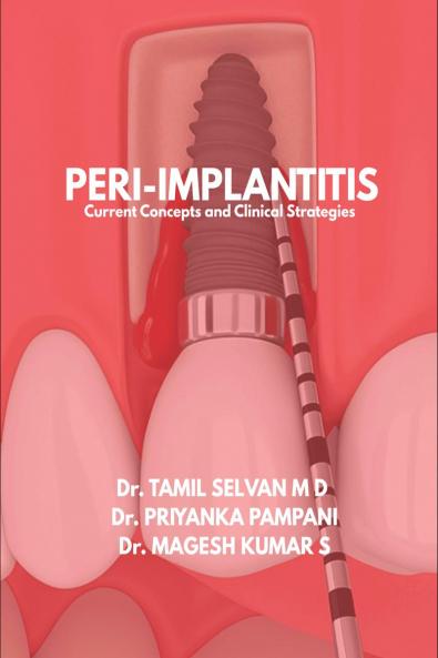 Peri-Implantitis: Current Concepts and Clinical Strategies
