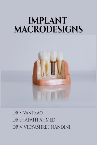 IMPLANT MACRODESIGNS