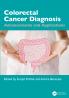 Colorectal Cancer Diagnosis