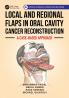 Local and Regional Flaps in Oral Cavity Cancer Reconstruction