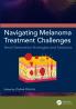 Navigating Melanoma Treatment Challenges