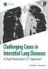 Challenging Cases in Interstitial Lung Diseases
