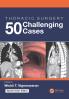 Thoracic Surgery: 50 Challenging cases