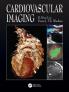 Cardiovascular Imaging