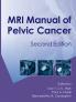MRI Manual of Pelvic CancerSecond Edition