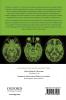 Neurological Case Histories