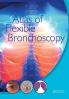 Atlas of Flexible Bronchoscopy