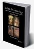 Ethnic Dermatology