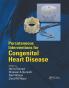 Percutaneous Interventions for Congenital Heart Disease