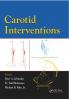 Carotid Interventions
