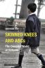 Skinned Knees and ABCs