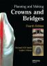 Planning and Making Crowns and Bridges