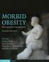 Morbid Obesity