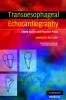 Transoesophageal Echocardiography
