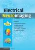 Electrical Neuroimaging
