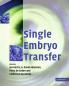 Single Embryo Transfer