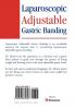 Laparoscopic Adjustable Gastric Banding