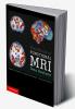 Handbook of Functional MRI Data Analysis