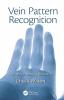 Vein Pattern Recognition