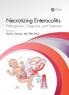 Necrotizing Enterocolitis