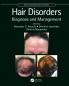 Hair Disorders