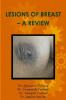 LESIONS OF BREAST - A REVIEW